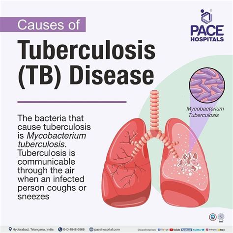 bad tb|Tuberculosis: Causes, Symptoms, Diagnosis